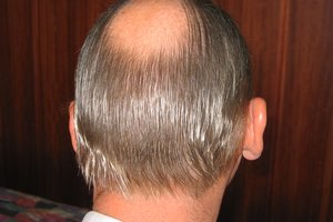 20041128_hair